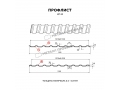 Профнастил МП-20x1100-R (ПЭ-01-5005-0,7)